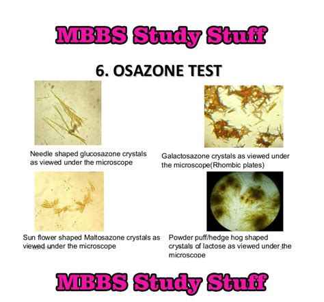 osazone test